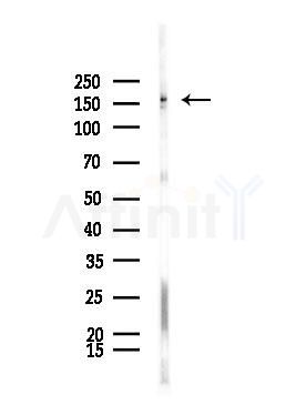 BCL9L Antibody - Western blot analysis of lysates from A375 cells(starvation,24h treatment), using BCL9L Antibody at 1/1000 dilution.