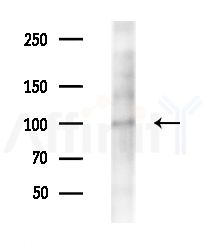 BAP1 Antibody - Western blot analysis of extracts from EC304 cells(heat-shock treatment), using BAP1 Antibody at 1/1000 dilution.
