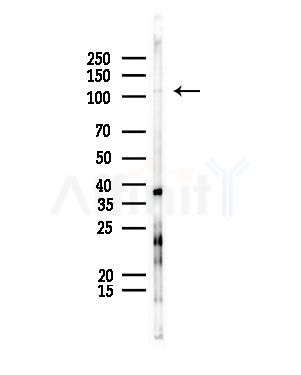 SHIP1 Antibody - Western blot analysis of lysates from Rat liver, using SHIP1 Antibody at 1/1000 dilution.