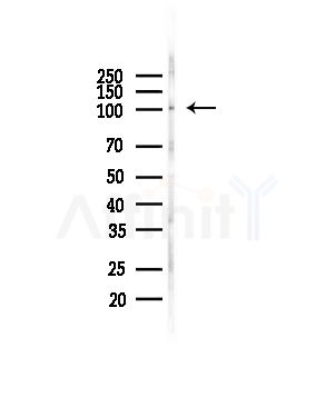 SHIP1 Antibody - Western blot analysis of lysates from COLO205 cells(heat-shock,45min treatment), using SHIP1 Antibody at 1/1000 dilution.