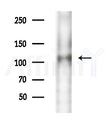 REPS1 Antibody - Western blot analysis of extracts from EC304 cells(heat-shock treatment), using REPS1 Antibody at 1/1000 dilution.