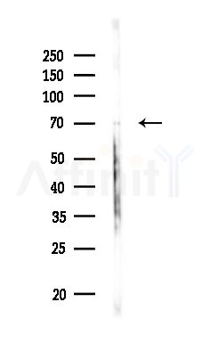 Sin1 Antibody - Western blot analysis of lysates from Rat brain, using Sin1 Antibody at 1/1000 dilution.