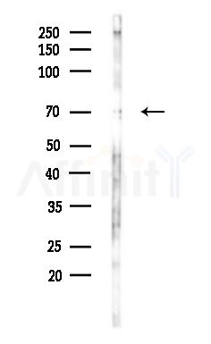 Sin1 Antibody - Western blot analysis of lysates from Hela cells(heat-shock,45min treatment), using Sin1 Antibody at 1/1000 dilution.