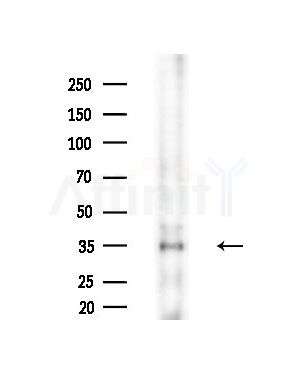 Phospho-CDK1/CDC2 (Thr161) Antibody - Western blot analysis of extracts from B16F10-LUC cells(heat-shock treatment), using Phospho-CDK1/CDC2 (Thr161) Antibody at 1/1000 dilution.
