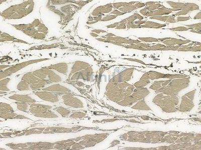 Phospho-CDK1/CDC2 (Thr161) Antibody - AF8001 at 1/100 staining mouse kidney tissue by IHC-P.