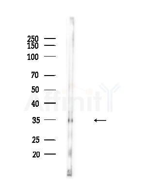 Phospho-CDK1/CDC2 (Thr161) Antibody - Western blot analysis of lysates from B16F10-LUC cells(heat-shock,45min treatment), using Phospho-CDK1/CDC2 (Thr161) Antibody at 1/1000 dilution.