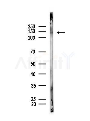 Phospho-TYK2 (Tyr1054) Antibody - Western blot analysis of lysates from Rat brain, using Phospho-TYK2 (Tyr1054) Antibody at 1/1000 dilution.