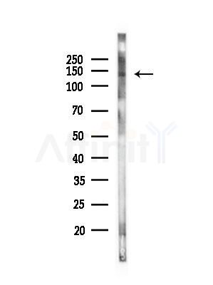 Phospho-TYK2 (Tyr1054) Antibody - Western blot analysis of lysates from COLO205 cells(heat-shock,45min treatment), using Phospho-TYK2 (Tyr1054) Antibody at 1/1000 dilution.