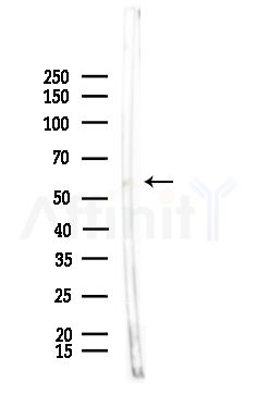 Phospho-BACE (Ser498) Antibody - Western blot analysis of lysates from Rat brain, using Phospho-BACE (Ser498) Antibody at 1/1000 dilution.