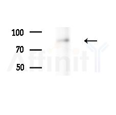 Phospho-NFAT1 (Ser326) Antibody - Western blot analysis of lysates from MDA-MB-231 cells(heat-shock,45min treatment), using Phospho-NFAT1 (Ser326) Antibody at 1/1000 dilution.