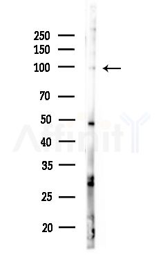 Phospho-NFAT1 (Ser326) Antibody - Western blot analysis of lysates from MDA-MB-231 cells(heat-shock,45min treatment), using Phospho-NFAT1 (Ser326) Antibody at 1/1000 dilution.