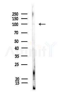 Phospho-NFAT2 (Ser294) Antibody - Western blot analysis of lysates from Rat lung, using Phospho-NFAT2 (Ser294) Antibody at 1/1000 dilution.