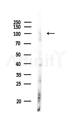 Phospho-NFAT2 (Ser294) Antibody - Western blot analysis of lysates from LoVo cells(heat-shock,45min treatment), using Phospho-NFAT2 (Ser294) Antibody at 1/1000 dilution.