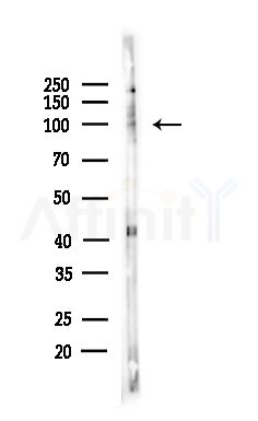 Phospho-NFAT2 (Ser294) Antibody - Western blot analysis of lysates from Hela cells(LPS,4h treatment), using Phospho-NFAT2 (Ser294) Antibody at 1/1000 dilution.