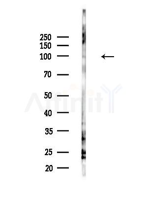 Phospho-NF kappaB p105/p50 (Ser923) Antibody - Western blot analysis of lysates from B16F10-LUC cells(LPS,4h treatment), using Phospho-NF kappaB p105/p50 (Ser923) Antibody at 1/1000 dilution.