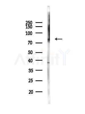 Phospho-PKC beta 1 (Ser661) Antibody - Western blot analysis of lysates from Rat liver, using Phospho-PKC beta 1 (Ser661) Antibody at 1/1000 dilution.