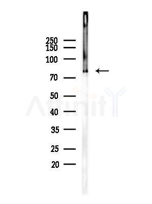 Phospho-PKC beta 1 (Ser661) Antibody - Western blot analysis of lysates from A375 cells(heat-shock,45min treatment), using Phospho-PKC beta 1 (Ser661) Antibody at 1/1000 dilution.