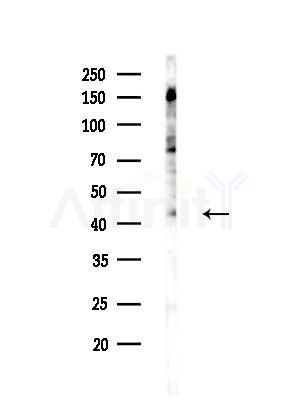 Phospho-AMPK beta 1 (Ser181) Antibody - Western blot analysis of lysates from EC304 cells(heat-shock treatment), using Phospho-AMPK beta 1 (Ser181) Antibody at 1/1000 dilution.