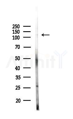 Phospho-RBL2 (Ser952) Antibody - Western blot analysis of lysates from 3T3-L1 P6(LPS, 4h treatment), using Phospho-RBL2 (Ser952) Antibody at 1/1000 dilution.