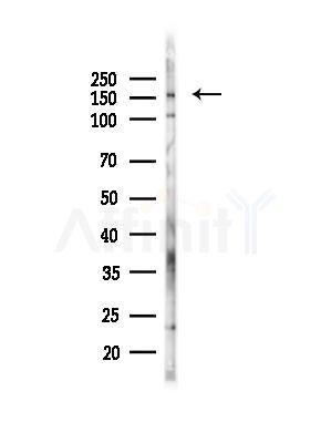 Phospho-CD130/gp130 (Ser782) Antibody - Western blot analysis of lysates from PC12 cells(heat-shock,45min treatment), using Phospho-CD130/gp130 (Ser782) Antibody at 1/1000 dilution.