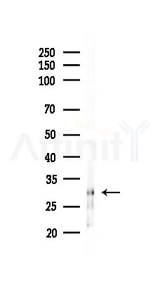 Phospho-p27 Kip1 (Ser178) Antibody - Western blot analysis of lysates from RAW264.