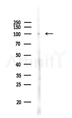 Phospho-Retinoblastoma (Ser612) Antibody - Western blot analysis of lysates from LoVo cells(heat-shock,45min treatment), using Phospho-Retinoblastoma (Ser612) Antibody at 1/1000 dilution.