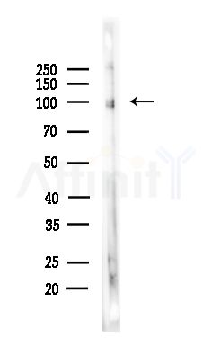 Phospho-Retinoblastoma (Ser612) Antibody - Western blot analysis of lysates from Hela cells(LPS,4h treatment), using Phospho-Retinoblastoma (Ser612) Antibody at 1/1000 dilution.