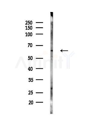 Phospho-Smad2 (Ser255) Antibody - Western blot analysis of lysates from B16F10-LUC cells(LPS,4h treatment), using Phospho-Smad2 (Ser255) Antibody at 1/1000 dilution.