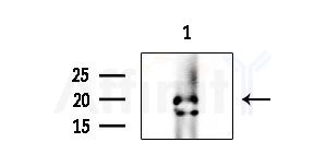 Phospho-Syndecan 4 (Ser179) Antibody - Western blot analysis of extracts from B16F10-LUC cells
(LPS 4h treatment), using Phospho-Syndecan 4 (Ser179) Antibody at 1/1000 dilution.