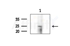 Phospho-Syndecan 4 (Ser179) Antibody - Western blot analysis of extracts from Mouse testis, using Phospho-Syndecan 4 (Ser179) Antibody at 1/1000 dilution.