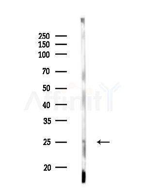 Phospho-Syndecan 4 (Ser179) Antibody - Western blot analysis of lysates from Mouse testis, using Phospho-Syndecan 4 (Ser179) Antibody at 1/1000 dilution.