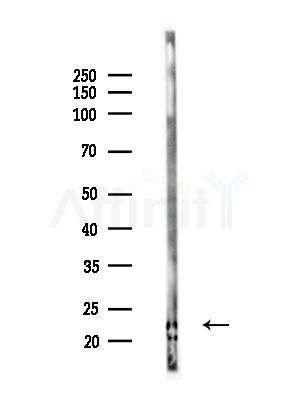 Phospho-Syndecan 4 (Ser179) Antibody - Western blot analysis of lysates from B16F10-LUC cells(LPS,4h treatment), using Phospho-Syndecan 4 (Ser179) Antibody at 1/1000 dilution.
