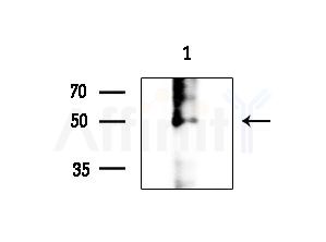 Phospho-HSF1 (Ser307) Antibody - Western blot analysis of extracts from B16F10-LUC cells
(LPS 4h treatment), using Phospho-HSF1 (Ser307) Antibody at 1/1000 dilution.