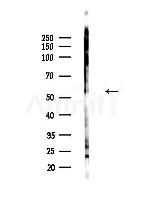 Phospho-HSF1 (Ser307) Antibody - Western blot analysis of lysates from B16F10-LUC cells(LPS,4h treatment), using Phospho-HSF1 (Ser307) Antibody at 1/1000 dilution.