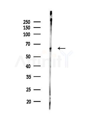 Phospho-ITK (Tyr512) Antibody - Western blot analysis of lysates from EC304 cells(heat-shock treatment), using Phospho-ITK (Tyr512) Antibody at 1/1000 dilution.