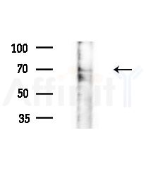 Phospho-Kv4.2/KCND2 (Ser616) Antibody - Western blot analysis of extracts from Rat brain, using Phospho-Kv4.