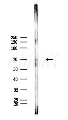 Phospho-Kv4.2/KCND2 (Ser616) Antibody - Western blot analysis of lysates from Rat brain, using Phospho-Kv4.