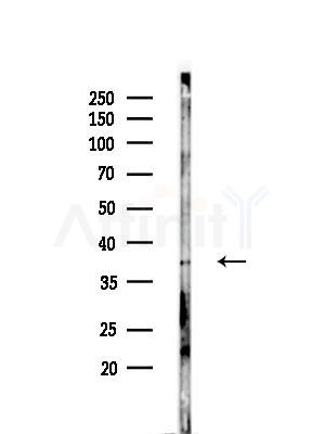 Phospho-MAX (Ser2) Antibody - Western blot analysis of lysates from EC304 cells(heat-shock treatment), using Phospho-MAX (Ser2) Antibody at 1/1000 dilution.