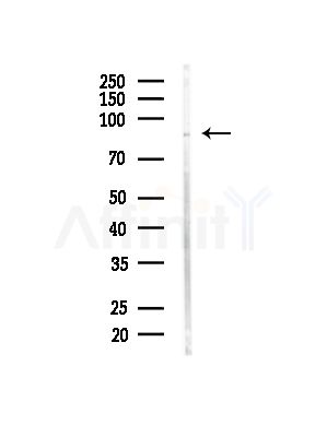 Phospho-TGF beta Receptor III (Thr843) Antibody - Western blot analysis of lysates from HUVEC cells(starvation,24h treatment), using Phospho-TGF beta Receptor III (Thr843) Antibody at 1/1000 dilution.