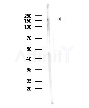 Phospho-eNOS (Ser1179) Antibody - Western blot analysis of lysates from Hela cells(UV,30min treatment), using Phospho-eNOS (Ser1179) Antibody at 1/1000 dilution.