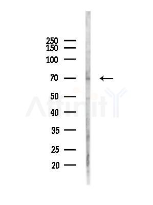 Phospho-Plastin L (Ser5) Antibody - Western blot analysis of lysates from A375 cells(heat-shock,45min treatment), using Phospho-Plastin L (Ser5) Antibody at 1/1000 dilution.