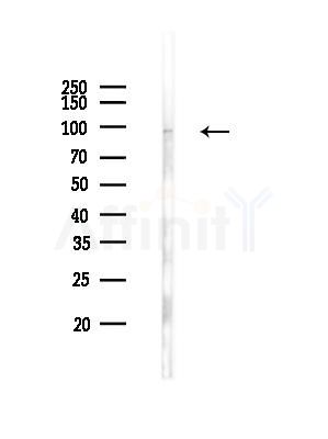 Phospho-PKD2 (Ser812) Antibody - Western blot analysis of lysates from PC12 cells(UV,30min treatment), using Phospho-PKD2 (Ser812) Antibody at 1/1000 dilution.