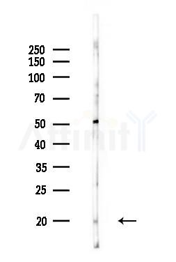 Phospho-VAMP4 (Ser30) Antibody - Western blot analysis of lysates from MCF7 cells(heat-shock,45min treatment), using Phospho-VAMP4 (Ser30) Antibody at 1/1000 dilution.