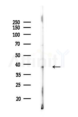 Phospho-ATF4 (Ser219) Antibody - Western blot analysis of lysates from MCF7 cells(heat-shock,45min treatment), using Phospho-ATF4 (Ser219) Antibody at 1/1000 dilution.
