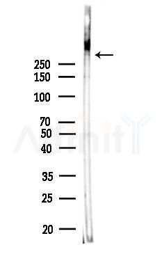Phospho-ATM (Ser1893) Antibody - Western blot analysis of lysates from K562 cells(heat-shock,45min treatment), using Phospho-ATM (Ser1893) Antibody at 1/1000 dilution.