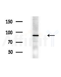 Phospho-beta Catenin (Ser675) Antibody - Western blot analysis of extracts from Mouse liver, using Phospho-beta Catenin (Ser675) Antibody at 1/1000 dilution.