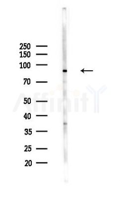 Phospho-beta Catenin (Ser675) Antibody - Western blot analysis of lysates from Mouse liver, using Phospho-beta Catenin (Ser675) Antibody at 1/1000 dilution.