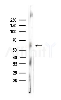 Phospho-Caspase 8 (Tyr448) Antibody - Western blot analysis of lysates from Mouse testis, using Phospho-Caspase 8 (Tyr448) Antibody at 1/1000 dilution.