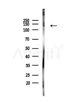 Phospho-EGFR (Tyr998) Antibody - Western blot analysis of lysates from A375 cells(heat-shock,45min treatment), using Phospho-EGFR (Tyr998) Antibody at 1/1000 dilution.