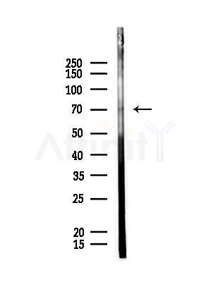Phospho-FOXO4 (Thr455) Antibody - Western blot analysis of lysates from Rat lung, using Phospho-FOXO4 (Thr455) Antibody at 1/1000 dilution.